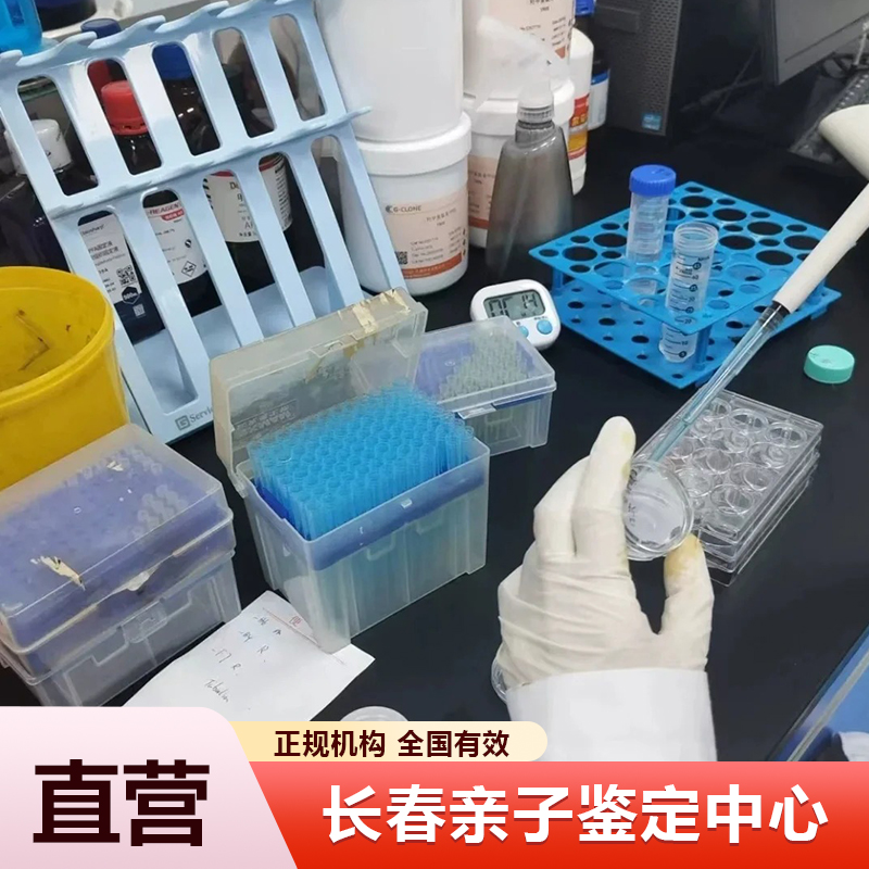 长春亲子鉴定中心